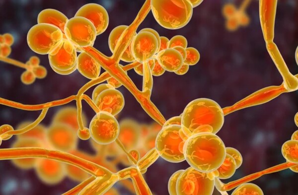 워싱턴 주, 위험한 내성 곰팡이 감염 발병 첫 확인